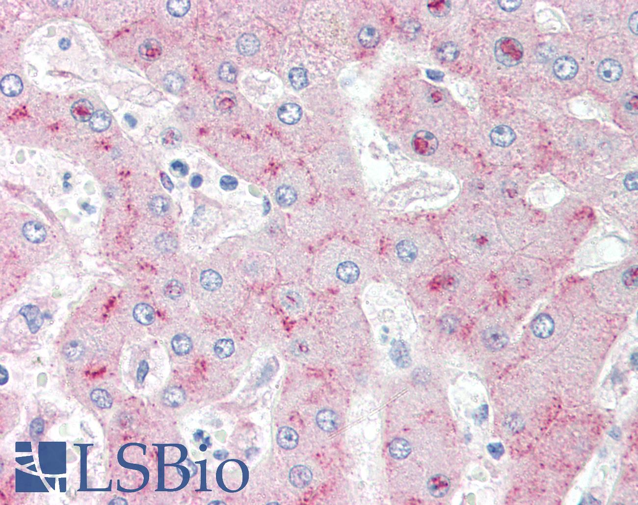 LRP1 / CD91 Antibody - Anti-LRP1 / Low Density LRP antibody IHC of human liver. Immunohistochemistry of formalin-fixed, paraffin-embedded tissue after heat-induced antigen retrieval. Antibody concentration 10 ug/ml. This image was taken for the unmodified form of this product. Other forms have not been tested.