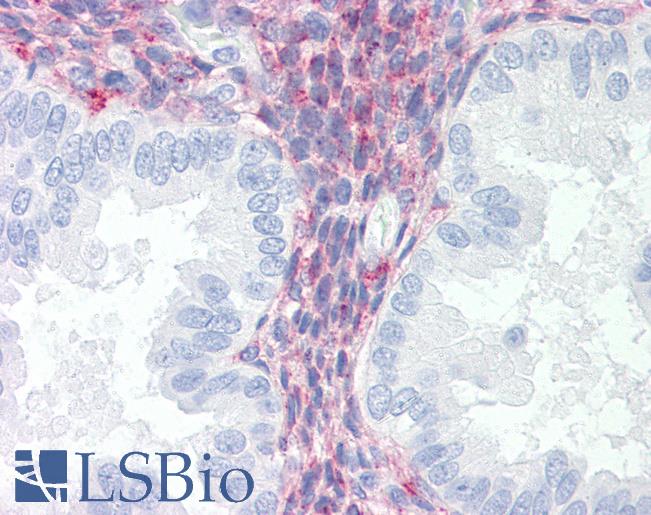 LRP1 / CD91 Antibody - Anti-LRP1 / Low Density LRP antibody IHC of human uterus. Immunohistochemistry of formalin-fixed, paraffin-embedded tissue after heat-induced antigen retrieval. Antibody concentration 10 ug/ml. This image was taken for the unmodified form of this product. Other forms have not been tested.