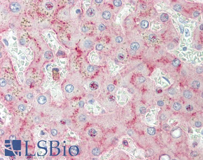 LRP1 / CD91 Antibody - Anti-LRP1 / CD91 antibody IHC staining of human liver. Immunohistochemistry of formalin-fixed, paraffin-embedded tissue after heat-induced antigen retrieval.
