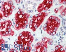 LRP2 / Megalin Antibody - Human Kidney: Formalin-Fixed, Paraffin-Embedded (FFPE)