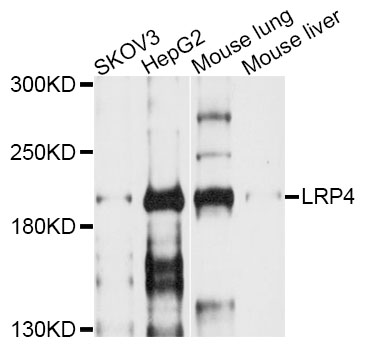 LRP4 Antibody - Western blot analysis of extracts of various cell lines, using LRP4 antibody at 1:1000 dilution. The secondary antibody used was an HRP Goat Anti-Rabbit IgG (H+L) at 1:10000 dilution. Lysates were loaded 25ug per lane and 3% nonfat dry milk in TBST was used for blocking.