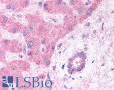 LRP6 Antibody - Anti-LRP6 antibody IHC of human hepatocytes and bile duct. Immunohistochemistry of formalin-fixed, paraffin-embedded tissue after heat-induced antigen retrieval. Antibody concentration 5 ug/ml.