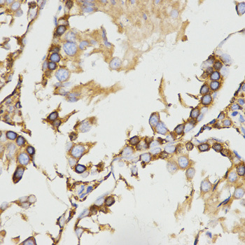 LRPAP1 Antibody - Immunohistochemistry of paraffin-embedded rat testis tissue using LRPAP1 antibody at dilution of 1:200 (x400 lens)