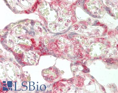 LRPAP1 Antibody - Human Placenta: Formalin-Fixed, Paraffin-Embedded (FFPE)