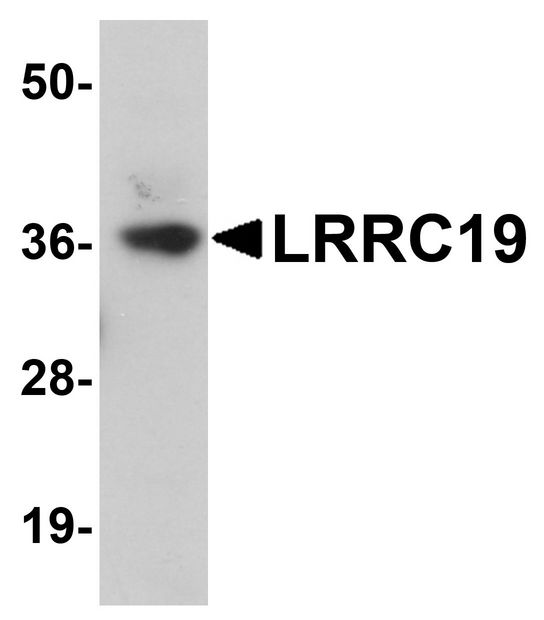 LRRC19 Antibody - Western blot analysis of LRRC19 in K562 cell lysate with LRRC19 antibody at 1 ug/ml.