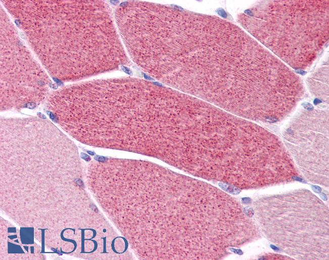 LRRC19 Antibody - Anti-LRRC19 antibody IHC of human skeletal muscle. Immunohistochemistry of formalin-fixed, paraffin-embedded tissue after heat-induced antigen retrieval. Antibody concentration 5 ug/ml.