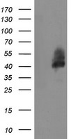 LRRC25 Antibody - HEK293T cells were transfected with the pCMV6-ENTRY control (Left lane) or pCMV6-ENTRY LRRC25 (Right lane) cDNA for 48 hrs and lysed. Equivalent amounts of cell lysates (5 ug per lane) were separated by SDS-PAGE and immunoblotted with anti-LRRC25. At a dilution of 1:2000.