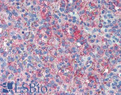 LRRC25 Antibody - Human Spleen: Formalin-Fixed, Paraffin-Embedded (FFPE), at a concentration of 10 ug/ml. 