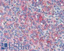 LRRC25 Antibody - Human Spleen: Formalin-Fixed, Paraffin-Embedded (FFPE), at a concentration of 10 ug/ml. 