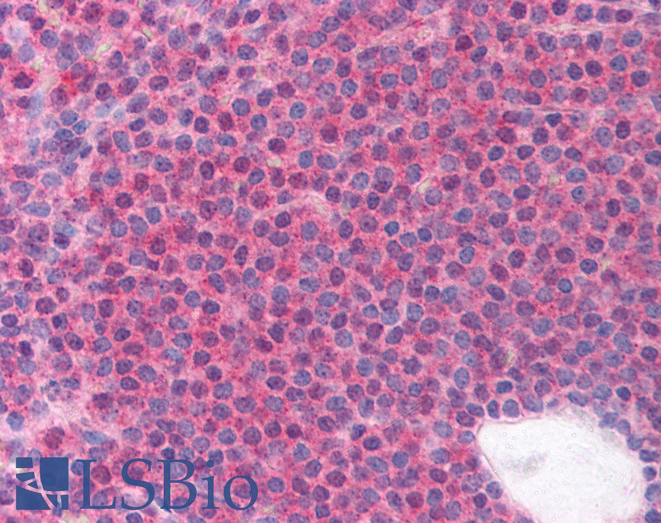 LRRC3B Antibody - Anti-LRRC3B / LRP15 antibody IHC of human spleen. Immunohistochemistry of formalin-fixed, paraffin-embedded tissue after heat-induced antigen retrieval. Antibody concentration 5 ug/ml.