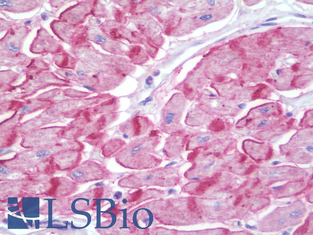 LRRC41 Antibody - Anti-LRRC41 antibody IHC staining of human heart. Immunohistochemistry of formalin-fixed, paraffin-embedded tissue after heat-induced antigen retrieval. Antibody dilution 1:100.