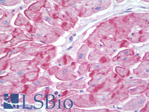 LRRC41 Antibody - Anti-LRRC41 antibody IHC staining of human heart. Immunohistochemistry of formalin-fixed, paraffin-embedded tissue after heat-induced antigen retrieval. Antibody dilution 1:100.