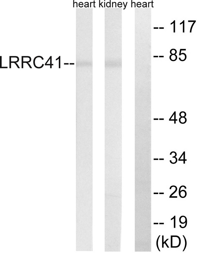 LRRC41 Antibody - Western blot analysis of lysates from rat kidney and rat heart cells, using LRRC41 Antibody. The lane on the right is blocked with the synthesized peptide.