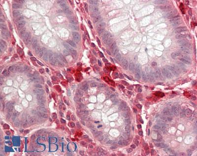 LRRC8A / LRRC8 Antibody - Human Colon: Formalin-Fixed, Paraffin-Embedded (FFPE)