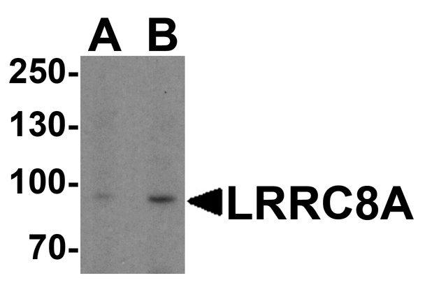LRRC8A / LRRC8 Antibody - Western blot analysis of LRRC8A in EL4 cell lysate with LRRC8A antibody at (A) 1 and (B) 2 ug/ml.