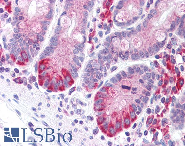 LRRN4 / C20orf75 Antibody - Anti-LRRN4 / C20orf75 antibody IHC of human small intestine. Immunohistochemistry of formalin-fixed, paraffin-embedded tissue after heat-induced antigen retrieval.
