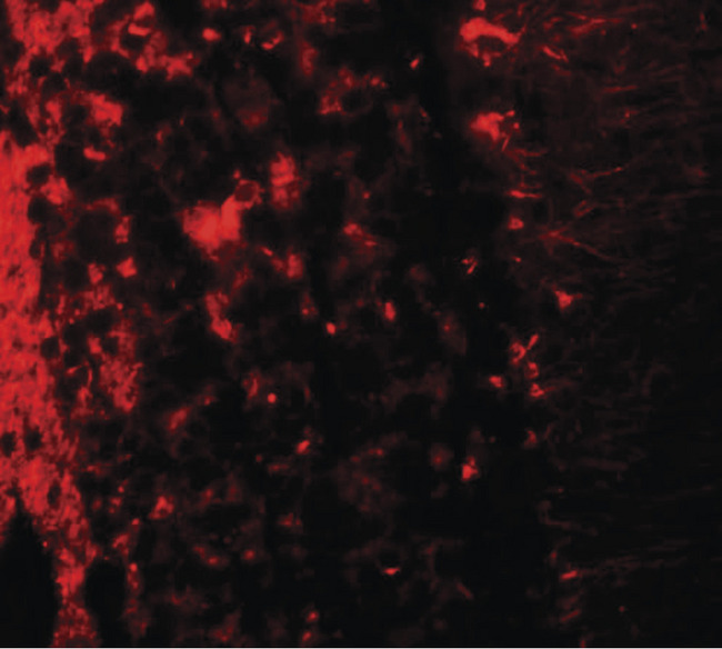 LRRTM2 Antibody - Immunofluorescence of LRRTM2 in human brain tissue with LRRTM2 antibody at 20 ug/ml.
