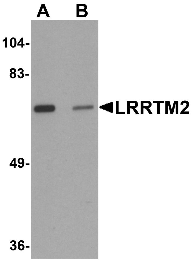 LRRTM2 Antibody - Western blot analysis of LRRTM2 in SK-N-SH cell lysate with LRRTM2 antibody at 1 ug/ml in (A) the absence and (B) the presence of blocking peptide.