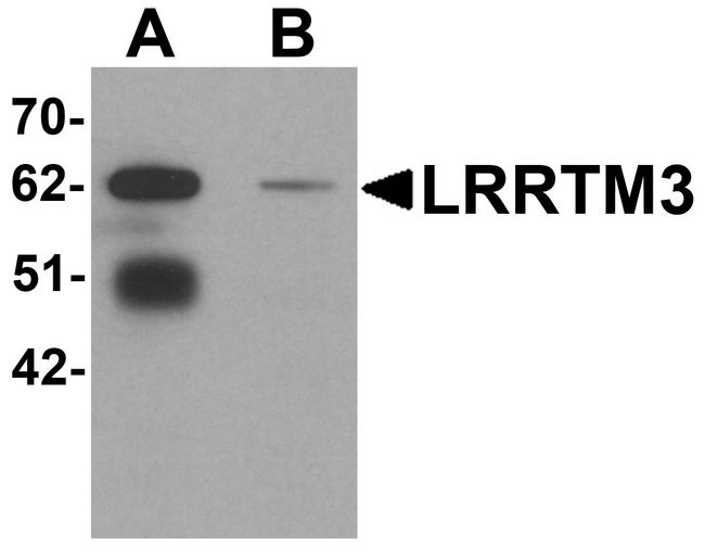 LRRTM3 Antibody - Western blot analysis of LRRTM3 in mouse brain tissue lysate with LRRTM3 antibody at 0.5 ug/ml in (A) the absence and (B) the presence of blocking peptide.