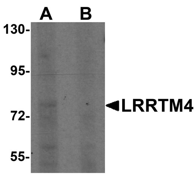 LRRTM4 Antibody - Western blot analysis of LRRTM4 in HeLa cell lysate with LRRTM4 antibody at 1 ug/ml in (A) the absence and (B) the presence of blocking peptide.