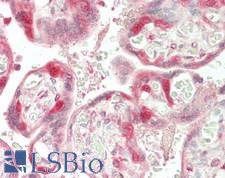 LRTOMT Antibody - Human Placenta: Formalin-Fixed, Paraffin-Embedded (FFPE)