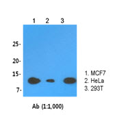 LSM2 / SnRNP Antibody - Western Blot: The cell lysates (30 ug) were resolved by SDS-PAGE, transferred to PVDF membrane and probed with anti-human LSm2 antibody (1:1,000). Proteins were visualized using a goat anti-mouse secondary antibody conjugated to HRP and an ECL detection system.