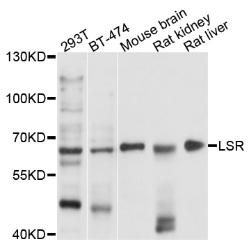 LSR / LISCH7 Antibody - Western blot analysis of extracts of various cell lines.