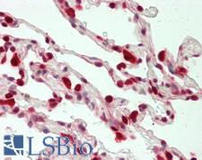 LTA4H / LTA4 Antibody - Human Lung: Formalin-Fixed, Paraffin-Embedded (FFPE)