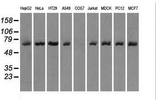 LTA4H / LTA4 Antibody - Western blot of extracts (35 ug) from 9 different cell lines by using anti-LTA4H monoclonal antibody.