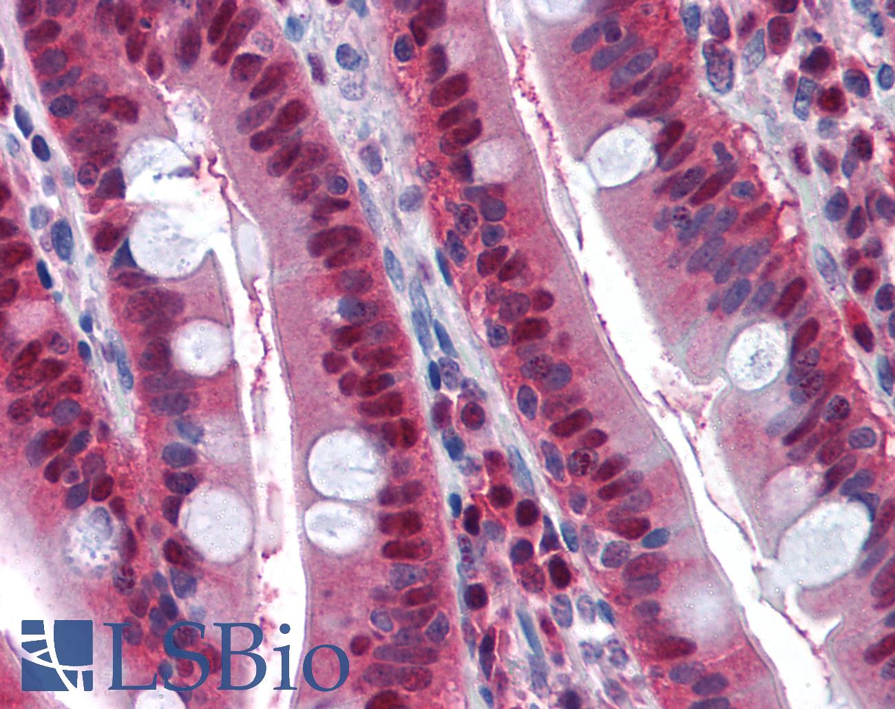 LTA4H / LTA4 Antibody - Anti-LTA4H antibody IHC of human small intestine. Immunohistochemistry of formalin-fixed, paraffin-embedded tissue after heat-induced antigen retrieval. Antibody concentration 5 ug/ml.