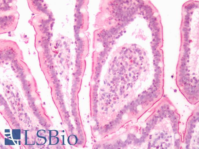LTB4R2 / BLT2 Antibody - Human Small Intestine: Formalin-Fixed, Paraffin-Embedded (FFPE)