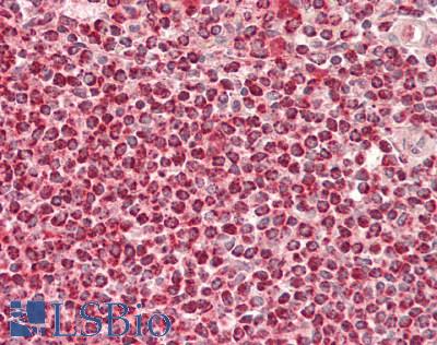 LTBR Antibody - Human Spleen: Formalin-Fixed, Paraffin-Embedded (FFPE)