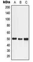 LTBR Antibody - Western blot analysis of LTBR expression in HeLa (A); HuT78 (B); K562 (C) whole cell lysates.