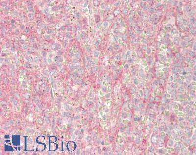 LTK Antibody - Human Spleen: Formalin-Fixed, Paraffin-Embedded (FFPE)