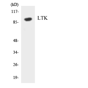 LTK Antibody - Western blot analysis of the lysates from HeLa cells using LTK antibody.