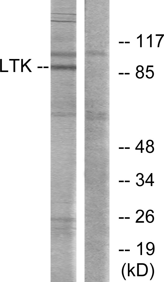 LTK Antibody - Western blot analysis of lysates from Jurkat cells, using LTK Antibody. The lane on the right is blocked with the synthesized peptide.