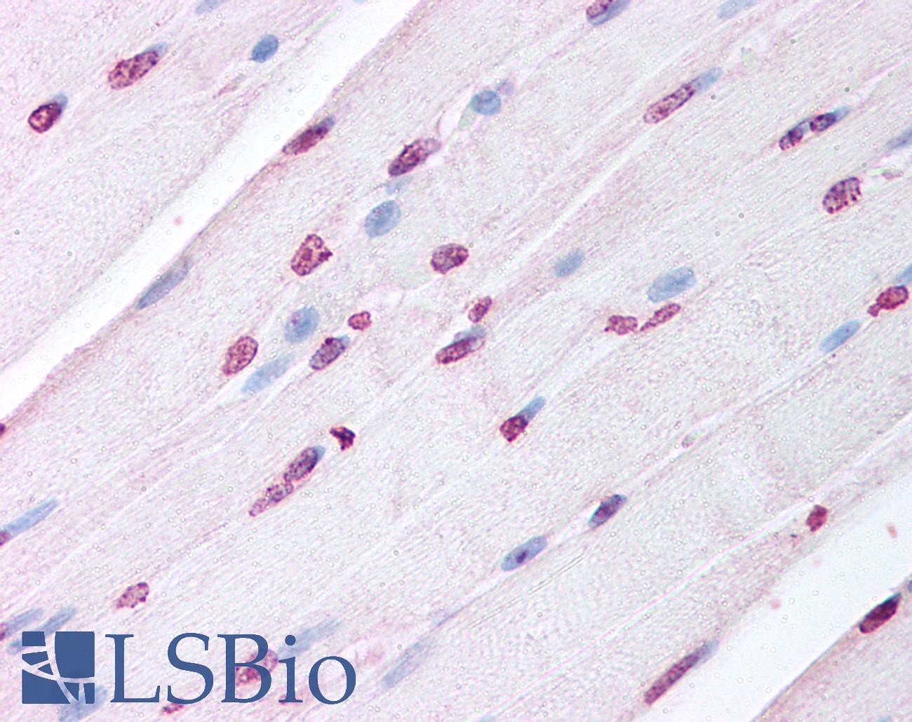 LXR Alpha+Beta Antibody - Anti-LXR Alpha/Beta antibody IHC of human skeletal muscle. Immunohistochemistry of formalin-fixed, paraffin-embedded tissue after heat-induced antigen retrieval. Antibody concentration 5 ug/ml.  This image was taken for the unconjugated form of this product. Other forms have not been tested.
