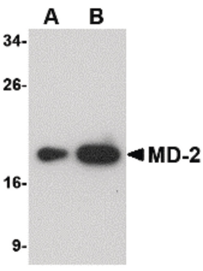 LY96 / MD2 / MD-2 Antibody - Western blot of (A) 25 and (B) 125 ng of MD-2 recombinant protein with MD-2 antibody at 1 ug/ml.