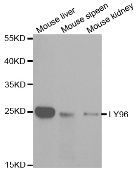 LY96 / MD2 / MD-2 Antibody - Western blot analysis of extracts of various cell lines, using LY96 antibody.