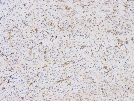 LY96 / MD2 / MD-2 Antibody - Immunohistochemistry of paraffin-embedded human endometrium using LY96 antibody at dilution of 1:100 (200x lens).
