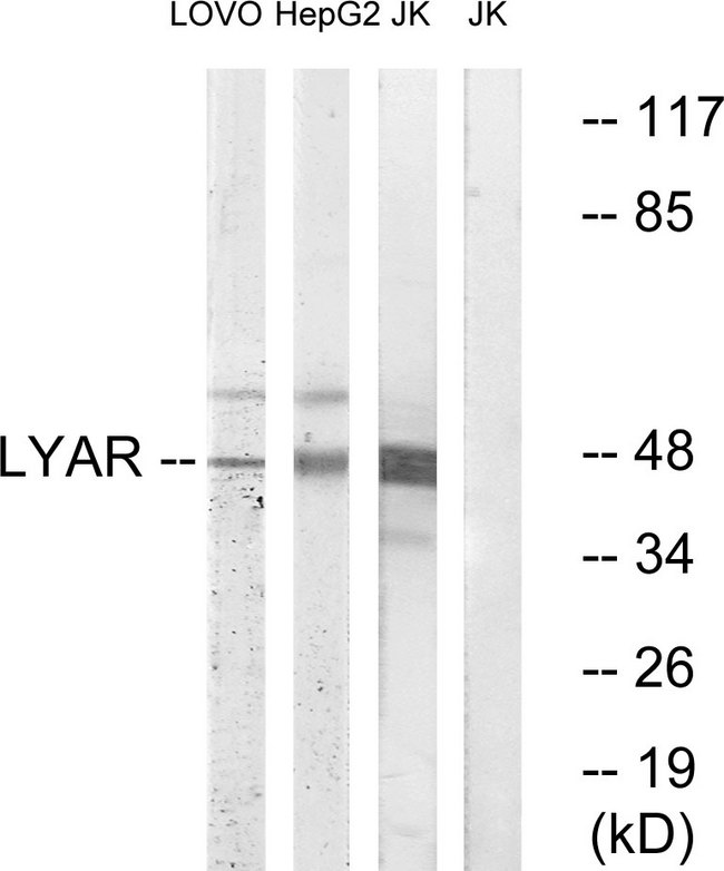 LYAR Antibody - Western blot analysis of lysates from Jurkat, HepG2, and LOVO cells, using LYAR Antibody. The lane on the right is blocked with the synthesized peptide.