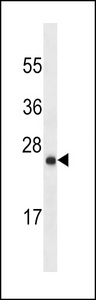 LYPD6B Antibody - LYPD6B Antibody (Ascites)western blot of mouse stomach tissue lysates (35 ug/lane). The LYPD6B antibody detected the LYPD6B protein (arrow).