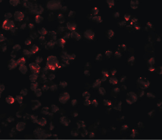 LYRM2 Antibody - Immunofluorescence of LYRM2 in A549 cells with LYRM2 antibody at 20 ug/ml.