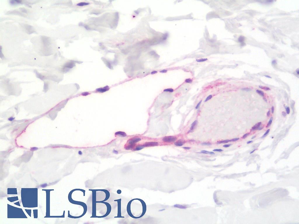 LYVE1 Antibody - Anti-LYVE1 / LYVE-1 antibody IHC staining of human breast. Immunohistochemistry of formalin-fixed, paraffin-embedded tissue after heat-induced antigen retrieval. Antibody dilution 1:100.