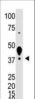 LYVE1 Antibody - The anti-XLKD1 N-term antibody is used in Western blot to detect XLKD1 in mouse liver tissue lysate.