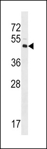 LYVE1 Antibody - XLKD1 Antibody western blot of Y79 cell line lysates (35 ug/lane). The XLKD1 antibody detected the XLKD1 protein (arrow).
