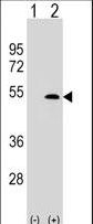 LYVE1 Antibody - Western blot of XLKD1 (arrow) using rabbit polyclonal XLKD1 Antibody (C61). 293 cell lysates (2 ug/lane) either nontransfected (Lane 1) or transiently transfected (Lane 2) with the XLKD1 gene.
