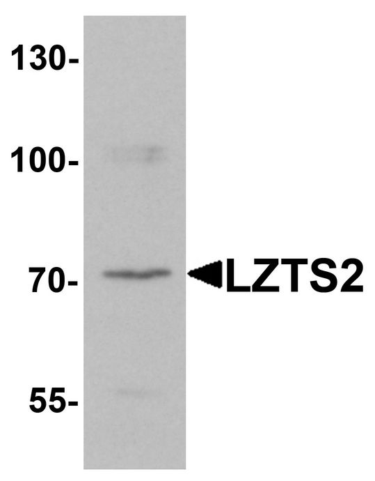 LZTS2 Antibody - Western blot analysis of LZTS2 in human kidney tissue lysate with LZTS2 antibody at 1 ug/ml.