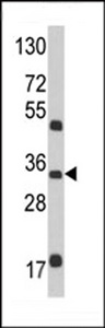 M6PR Antibody - Western blot of M6PR Antibody in mouse brain tissue lysates (35 ug/lane). M6PR (arrow) was detected using the purified antibody.