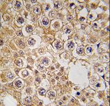 M6PR Antibody - Formalin-fixed and paraffin-embedded human testis tissue reacted with M6PR antibody , which was peroxidase-conjugated to the secondary antibody, followed by DAB staining. This data demonstrates the use of this antibody for immunohistochemistry; clinical relevance has not been evaluated.